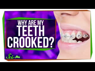 Why Do We Have Such Crooked Teeth