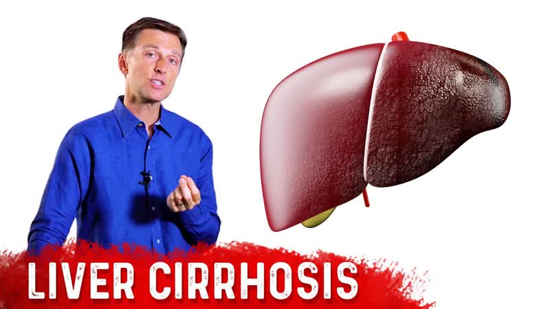 Is Liver Cirrhosis Reversible Fibrosis vs.