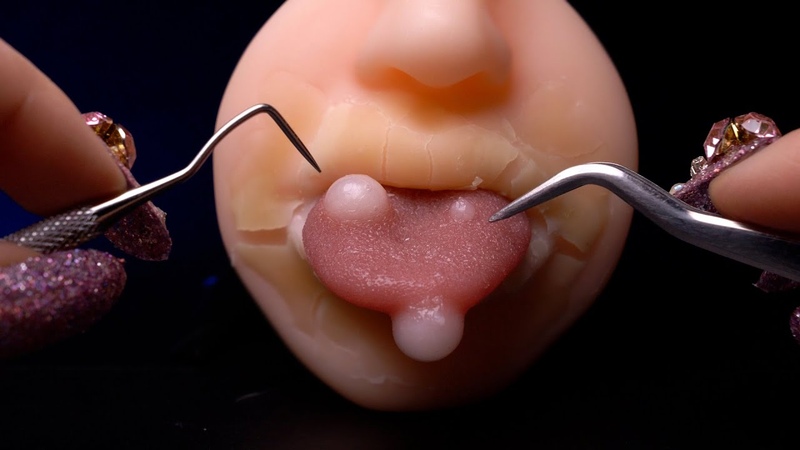 ASMR 飽き性の人向け シリコンの口と舌を治療する気持いい音 脱皮,