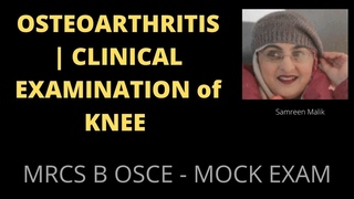 OSTEOARTHRITIS | CLINICAL EXAMINATION of KNEE