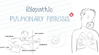 What is Idiopathic Pulmonary Fibrosis (IPF)?