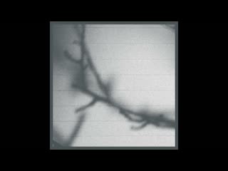 Zane Trow - Landscape (2024)